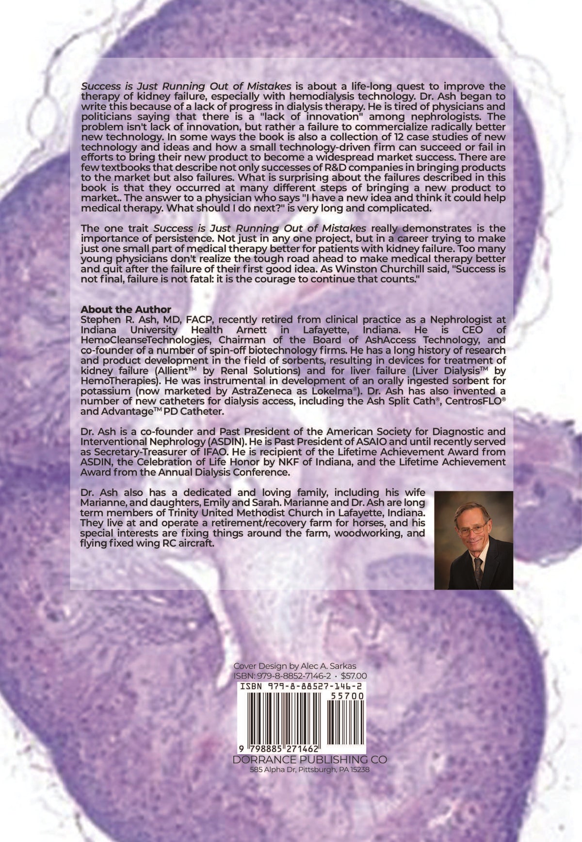 Success Is Just Running Out Of Mistakes: A Lifelong Quest To Make Hemodialysis Simple, Safe, And Effective